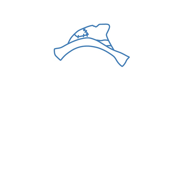 Hướng dẫn vẽ cậu bé Bù Nhìn. - Bước 1